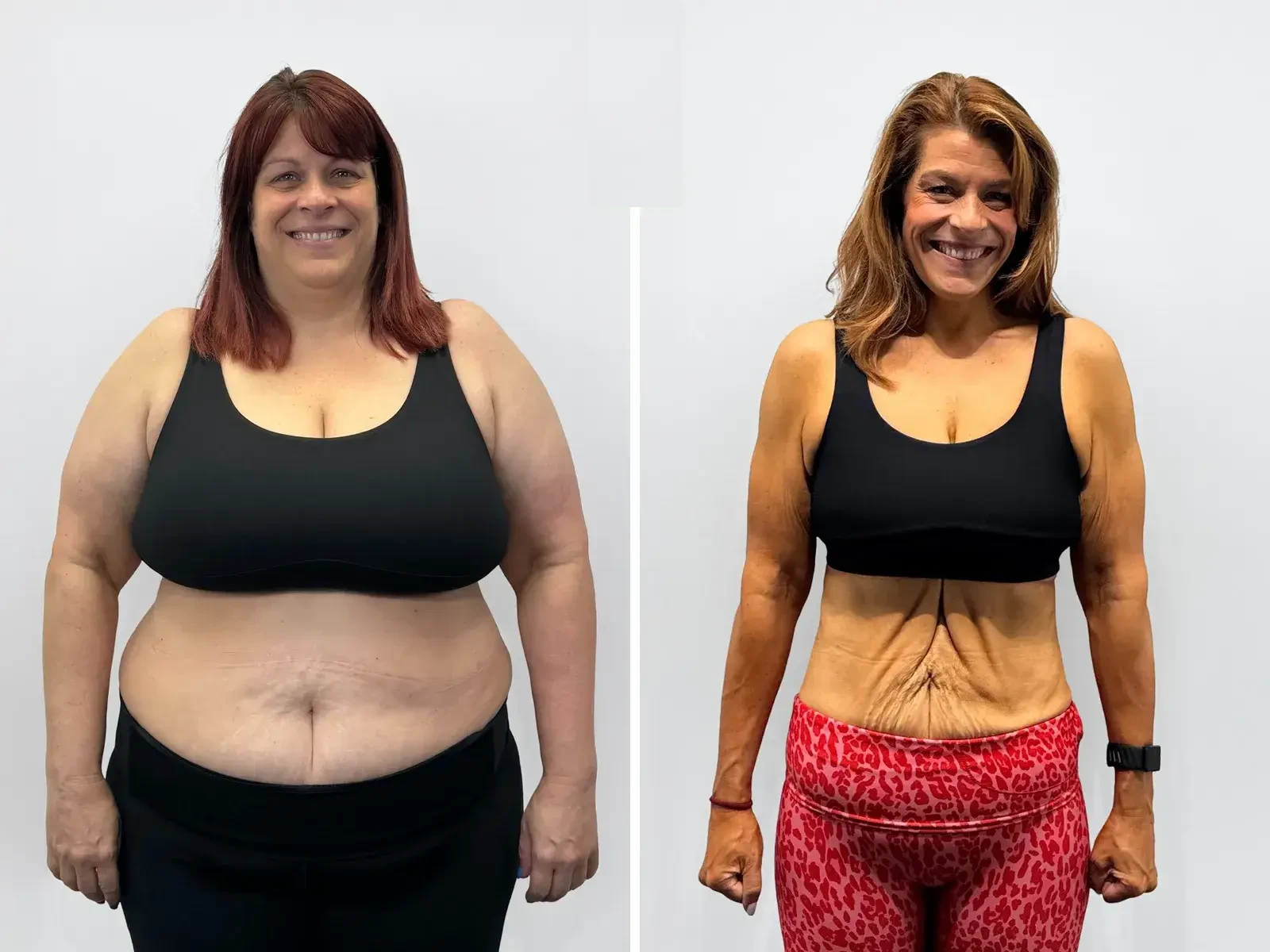 Lisa Lost 50kg at 50 &ndash; and Came Off the Medication She&rsquo;d Been on for 20 Years